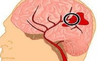 المهندس البحيري يبتكر جهاز طبيعي لعلاج مرضى الجلطات