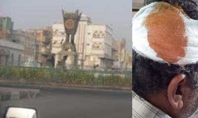 كلب مسعور يهاجم شخصان ويتسبب في إصابة احدهما في الشحر