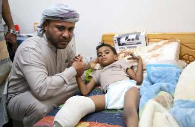 وجه بتكاليف رجل صناعية للطفل احمد .. العميد منير التميمي يطمئن على حالة المصابين جراء تفجير الشحر الإرهابي