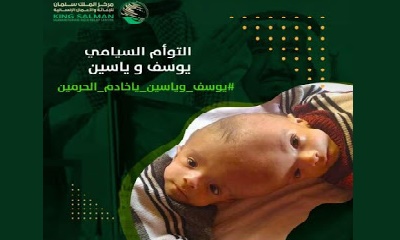 مدير عام مديرية شبام يشيد بجهود الحملة الإنسانية لمناصرة التوأم السيامي "يوسف وياسين" ويدعوا كافة أطياف المديرية لمناصرتها.