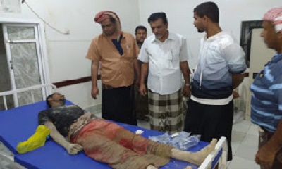 عاجل مصدر طبي في القطن وفاة شخص واصابة عشرة اخرين كحصيلة اولية لانهيار سقف محل في القطن