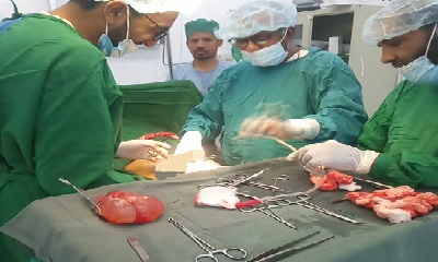 مستشفى شبام العام يُجري أول عمليتين لاستئصال القيلة المائية بنجاح