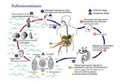 Yemen to launch campaign to get rid of schistosomiasis 