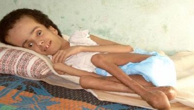 Welfare Fund: 10% of the population of Aden are disabled