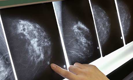  Late cancer diagnosis kills 10,000 a year according to government tsar