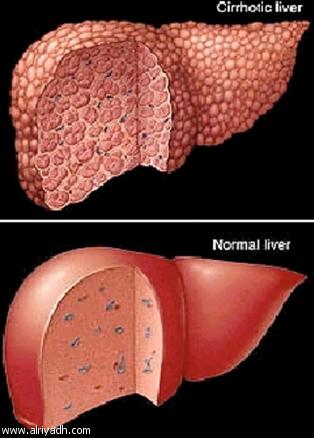    Conference on Diseases of the digestive and liver system takes place in Hadhramaut
