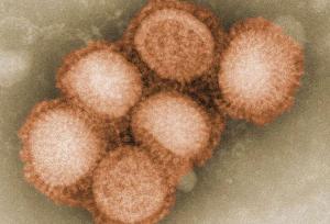 UK now third worst in world swine flu toll