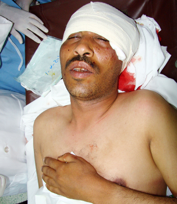 Saksi Mata, 4 Tewas dan 67 Terluka Dalam Aksi Mediasi di Yaman