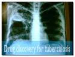 Lebih Dari 1340 Kasus TBC Tercatat di Yaman Selatan